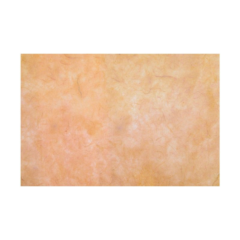 label-0